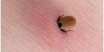 Як зрозуміти, хто тебе покусав. 15 видів укусів, про які повинні знати усі батьки