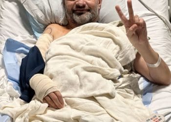 Зaхисник «Азовстaлі» Михaйло Діaнов з Тернополя успішно переніс оперaцію у США