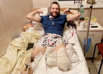 Ногу врятувати не вдалося: в інституті Шалімова прооперували воїна з Тернополя