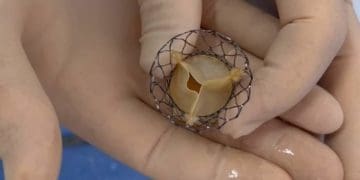 Тернопільські хірурги замінили літньому пацієнту серцевий клапан без розрізу грудини