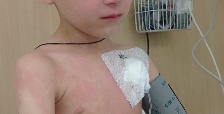 6-річний Ростик Рудніцький потребує допомоги у боротьбі із раком 4 стадії