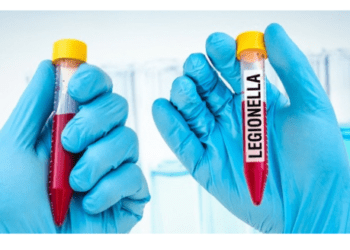 Польща хвороба легіонерів