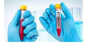 Польща хвороба легіонерів