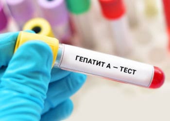 Гепатит А підтвердили у жительки Тернопільщини
