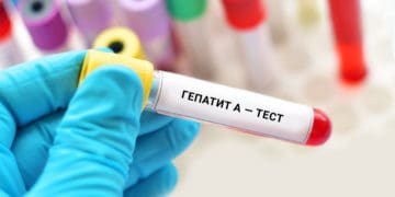 Гепатит А підтвердили у жительки Тернопільщини