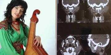 Відома тернопільська бандуристка і співачка збирає гроші на оперцію