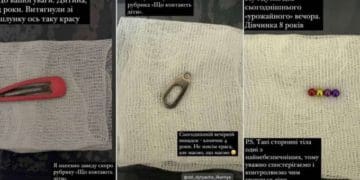 сторонні предмети