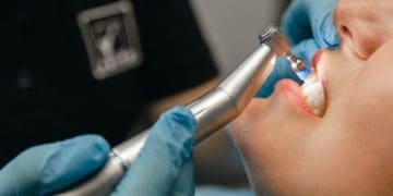 найпоширеніші запити до стоматолога