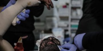 На передовій життя: як медики 24-ї ОМБр рятують героїв під вогнем