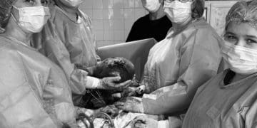 У Тернополі лікарі видалили пухлину матки вагою понад 3 кілограми: операція пройшла успішно