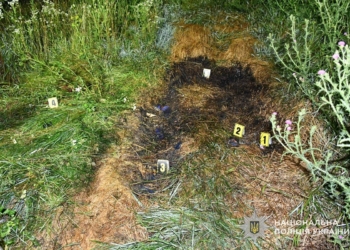 отримала важкі опіки