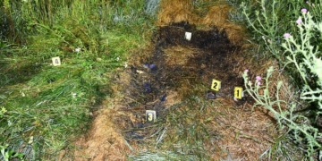 отримала важкі опіки