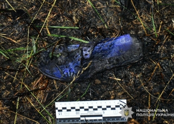 з термічними опіками