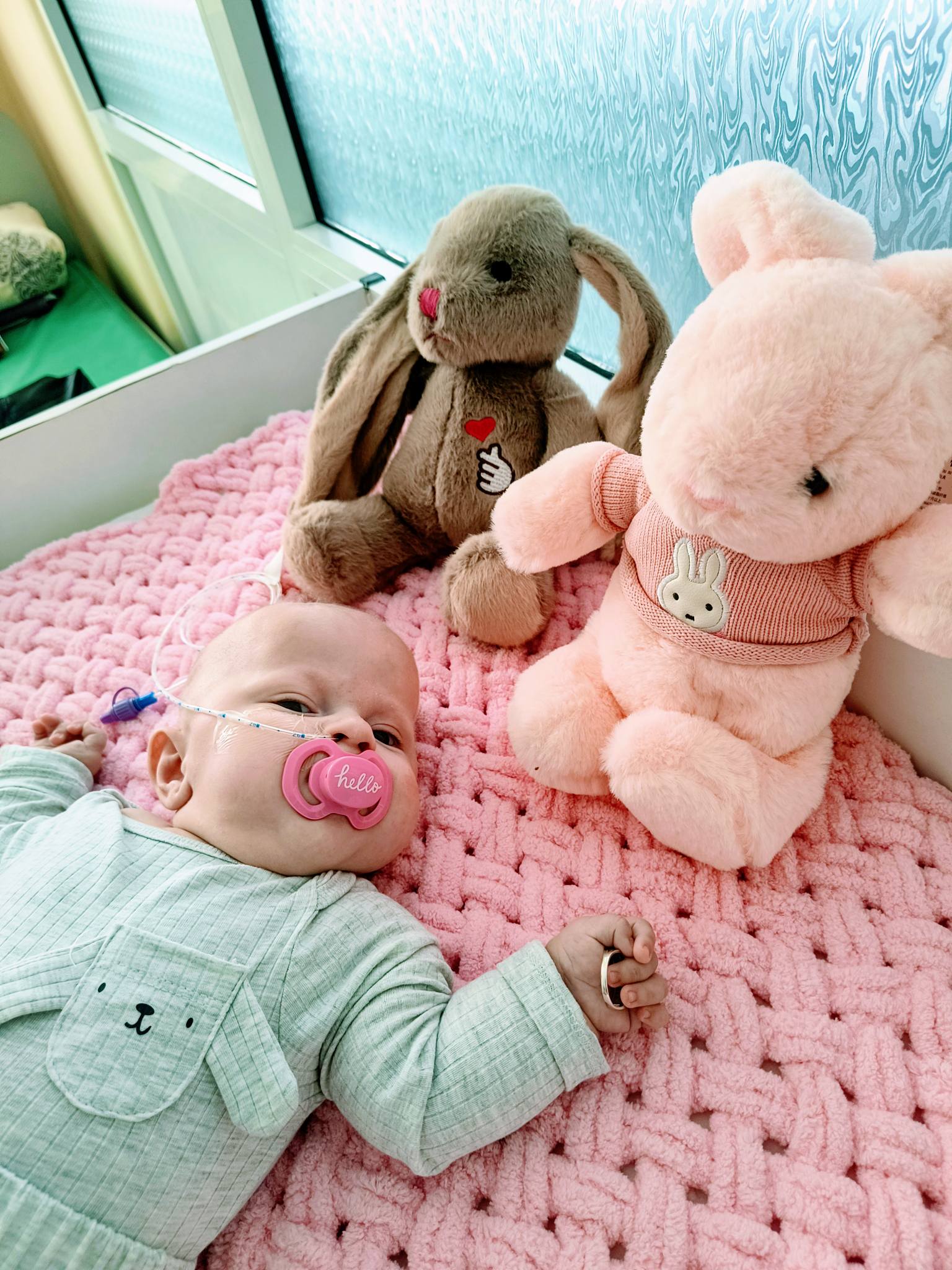 Феноменальний порятунок: у Львові прооперували мозок немовляти з Тернопільщини вагою лише 750 грамів