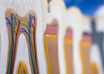 лікування кореневих каналів