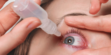 очні краплі від катаракти